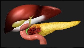 pancreatic