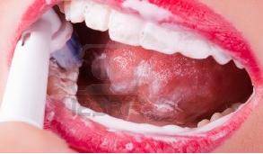 Ηλεκτρική οδοντόβουρτσα: 5 λόγοι για να την επιλέξετε
