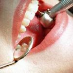 Φοβάστε τον οδοντίατρο; Πηγαίνετε σε... μουσικό!(Φωτο)